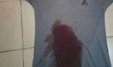 Nonogasta: una mujer denunció agresiones de su pareja y un hombre resultó herido con un arma blanca